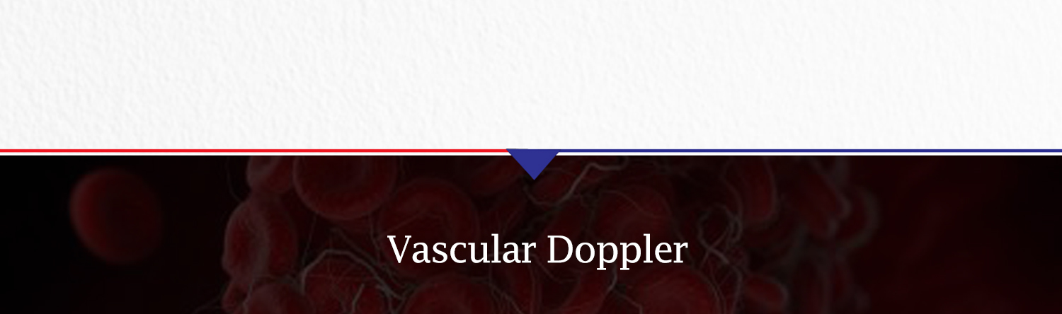 Vascular Doppler